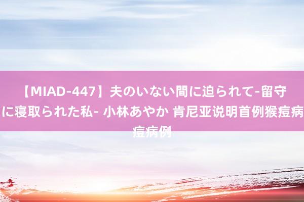 【MIAD-447】夫のいない間に迫られて-留守中に寝取られた私- 小林あやか 肯尼亚说明首例猴痘病例